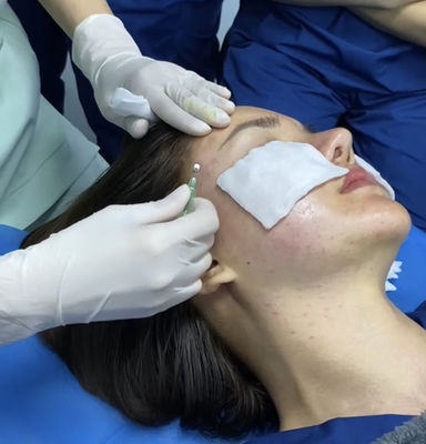 Deep Line Removal Collagen Regeneration Barbed PDO Threads