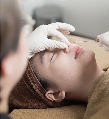 Fiona Absorbable Pdo Thread Lift Nose 60mm