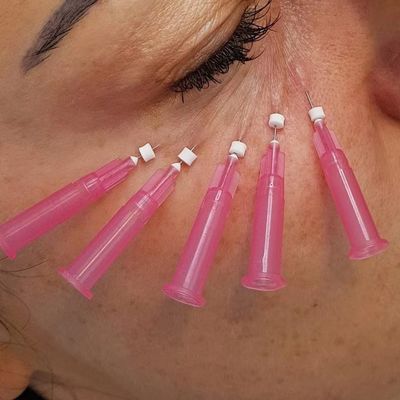 30g 25mm Pdo Pcl Absorbable Thread Lift W Type Blunt Cannula For Under Eye Volume Loss