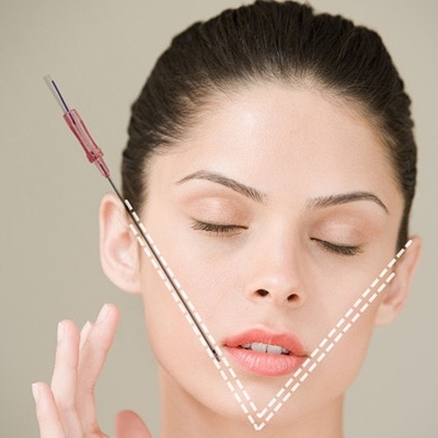 Nonsurgical PDO Thread Face Lifting Cog Thread 18G 100mm For Instant Face Lifting
