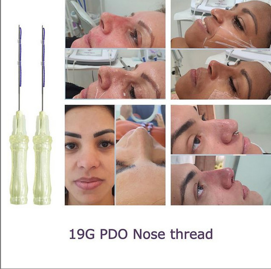 Fiona Absorbable Pdo Cog Thread Nose Lift For Nose Jobe Size 19G-60mm 19G-38mm