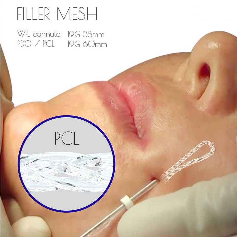 Hilo De Trenzado RegeneracióN De ColáGeno Mesh Thread 19G-38mm Y 19G-60mm